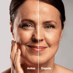 resultados legacyskin original suplemento com retinol